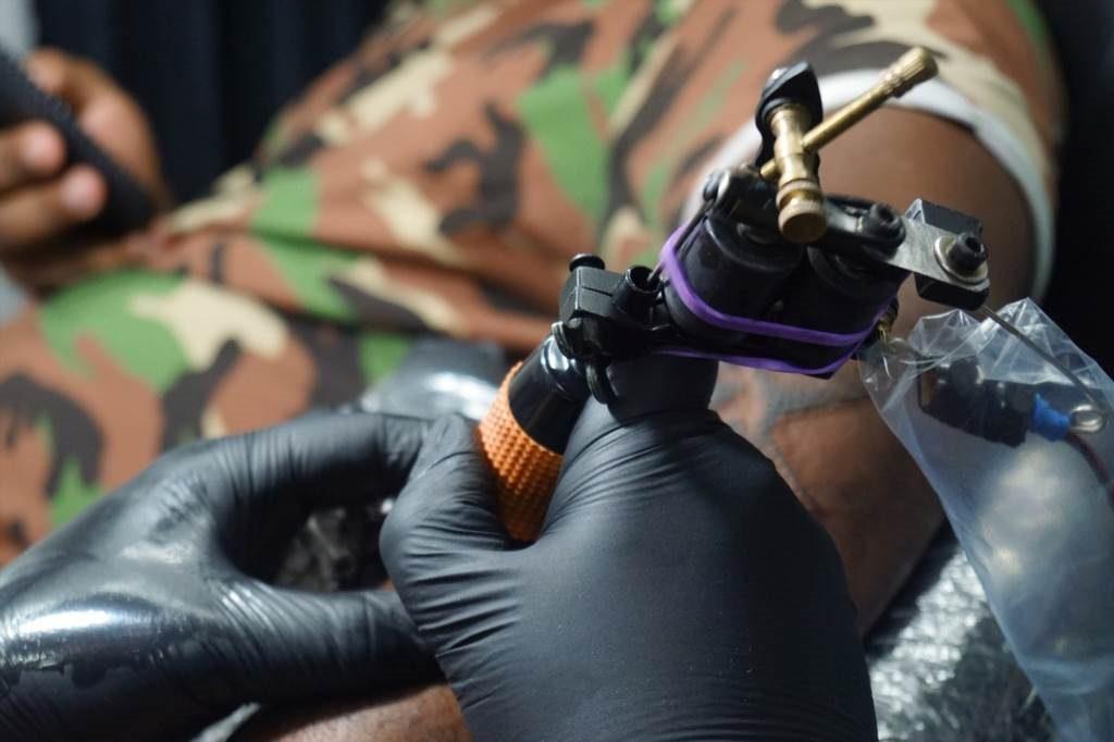 koszt usuniecia tatuazu