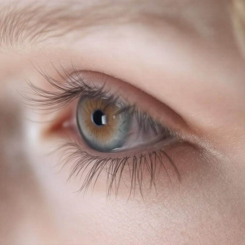 Leczenie domowe uczulenia na sztuczne rzęsy